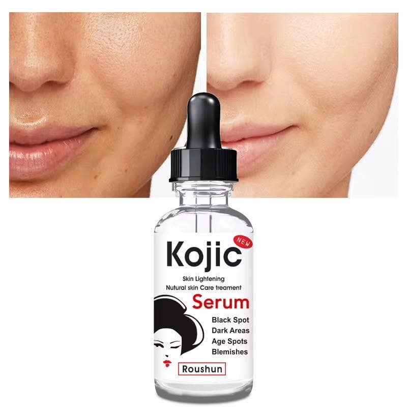 kojic skin lightening serum